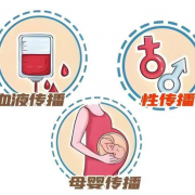 呼和浩特市回民区 阻断药能在药店买吗 ?艾滋病自我检测注意事项