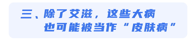 攀枝花市盐边县艾生特和特威凯哪个好？不要错把艾滋病当皮肤病，身体出现3个症状，或是艾滋病信号