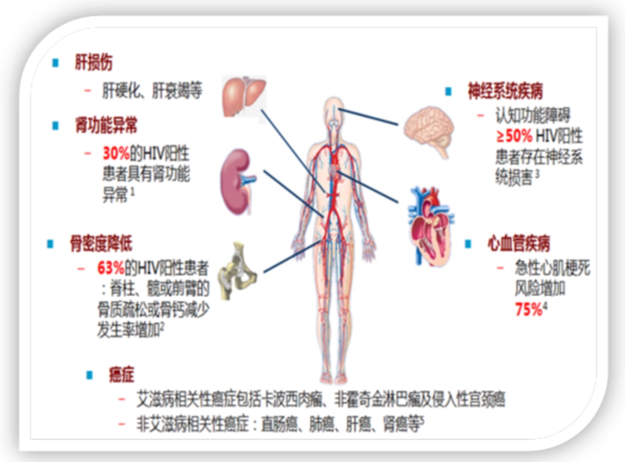 景德镇市乐平市特威凯哪里有卖？艾滋病感染者没有症状还需要抗病毒治疗吗？