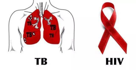 沈阳市铁西区阻断药为什么要吃28天？结核遇见艾滋，双重组合知多少？
