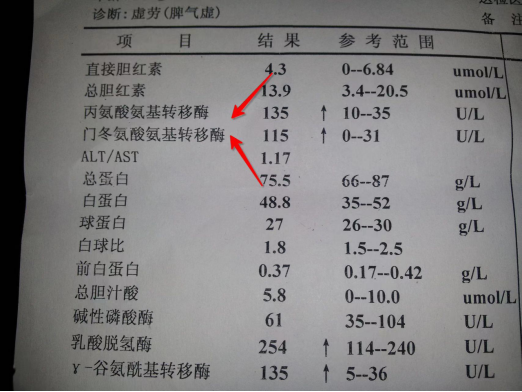 抚州市崇仁县疾控中心免费提供阻断药吗？【HIV感染者保护肝脏，从现在开始做起！肝功能异常及如何复查必知】