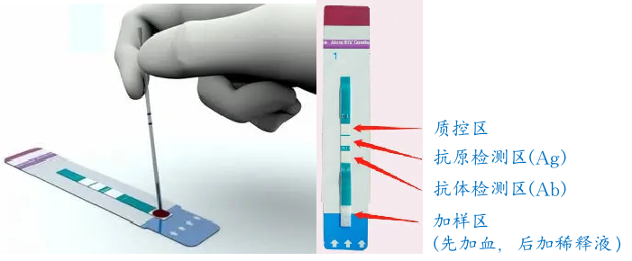 菏泽市曹县阻断药是干嘛的？艾滋病检测 您需要知道这些